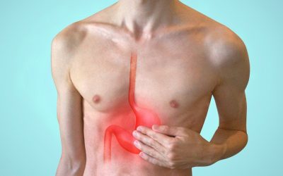 La malattia da reflusso gastro-esofageo